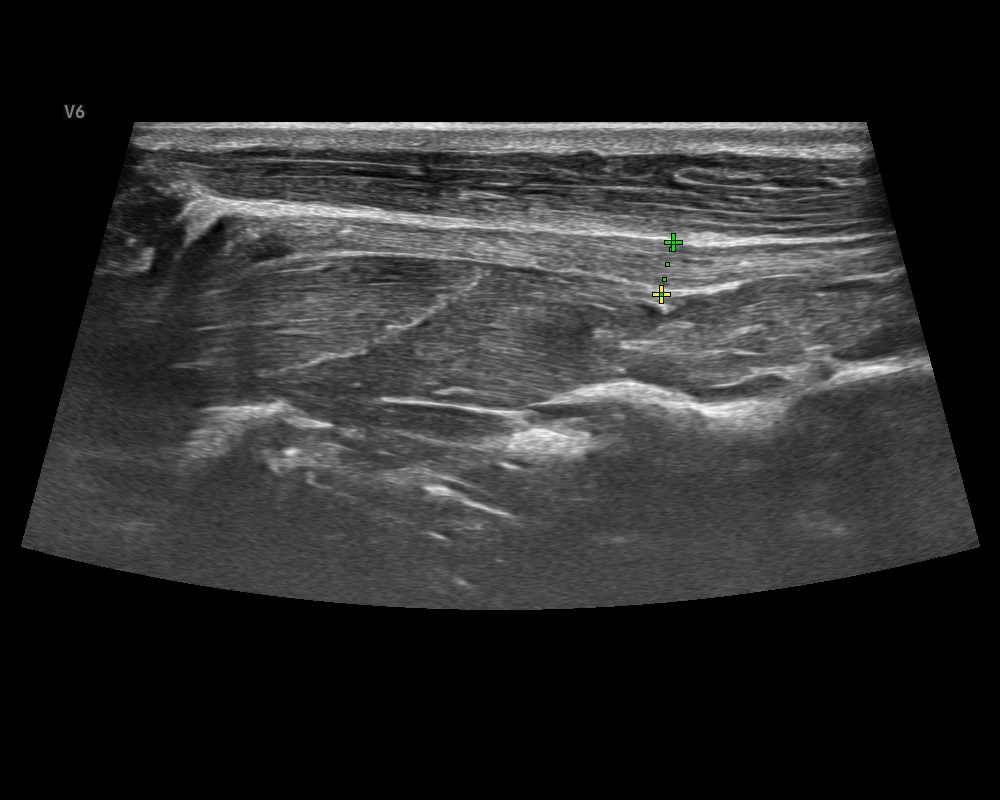 貓 甲狀腺 Cat_Thyroid gland.JPG