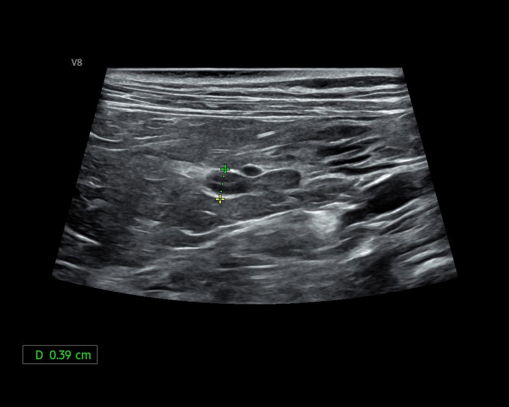 貓 腎上腺_Cat_Adrenal gland.JPG