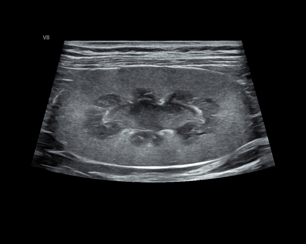 貓 腎臟 Cat_Kidney.JPG