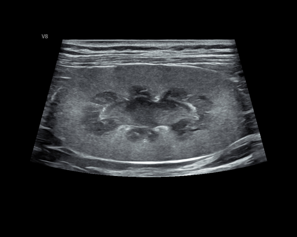 貓 腎臟 Cat_Kidney.JPG