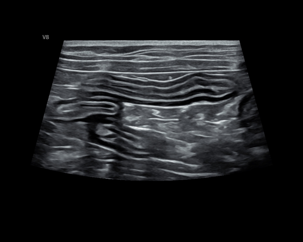 貓 腸道 Cat_Intestinal tract_Long axis.JPG