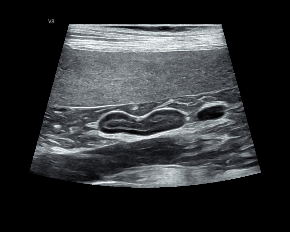 狗 腎上腺 Adrenal gland.JPG