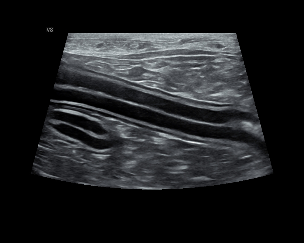 Dog_Intestinal tract.JPG